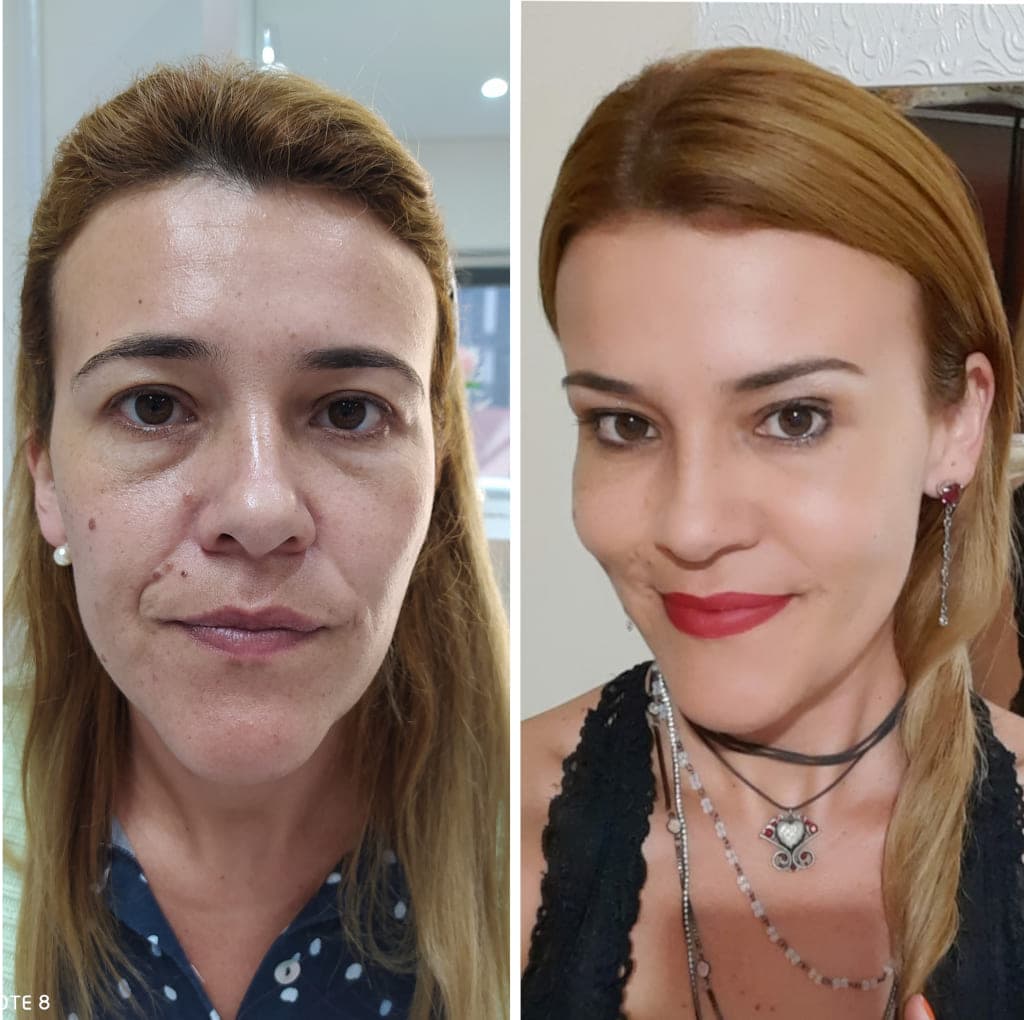 Antes e depois de tratamento